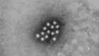 Hepatitis A Outbreak Hits Nashville