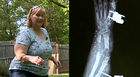 Woman Recovers After Vicious Dog Attack