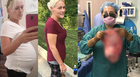 Woman Has 20 Pound Cyst Removed From Stomach