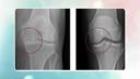 Regenerative Medicine: What is it and How it...